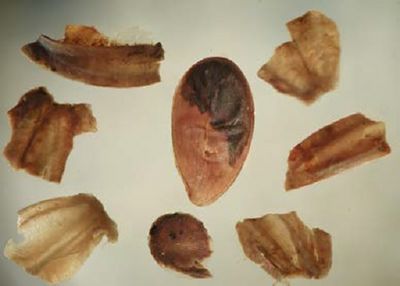Microscopische foto-weergave van zaden en vruchten.