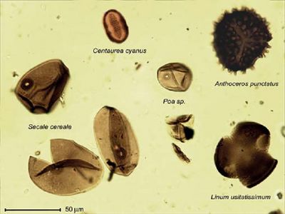 Microscopische foto stuifmeelkorrels.